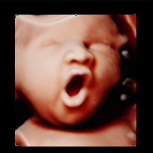 3D ultrasound image of baby face