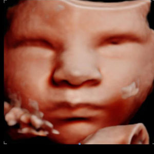 3D ultrasound baby profile
